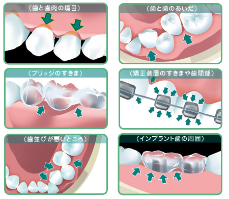 画像:ノズルを使う場合