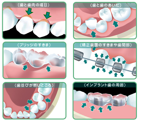 画像：ノズルを使う場合