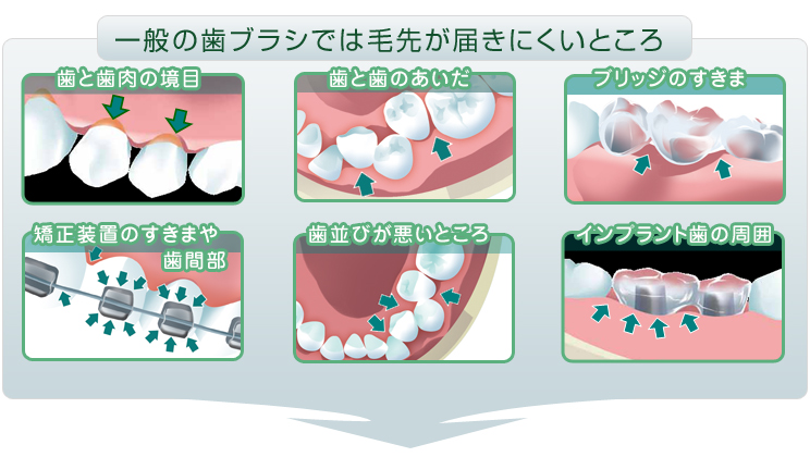 一般の歯ブラシでは毛先が届きにくいところ