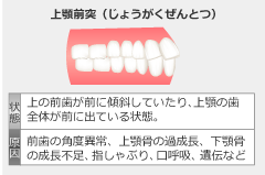 {O˂̐}