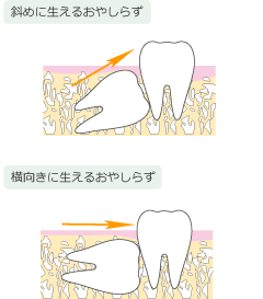 ΂߂ɐ邨₵炸Ɖɐ邨₵炸̐}