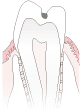 C1