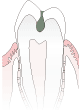 C2