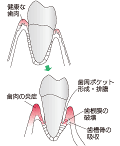̐is