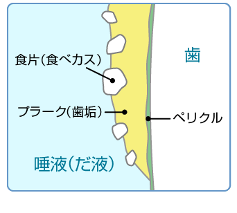 コイルチューブの取扱注意