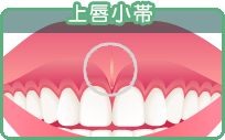 上唇小帯の図