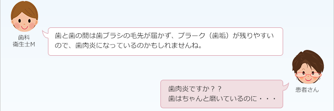 歯科衛生士M:
歯と歯の間は歯ブラシの毛先が届かず、プラーク(歯垢)が残りやすいので、歯肉炎になっているのかもしれませんね。
患者さん:
歯肉炎ですか??
歯はちゃんと磨いているのに・・・