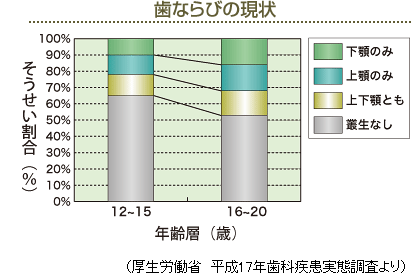 歯ならびの現状